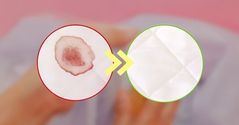 Cómo quitar manchas de sangre seca en telas sin lejía