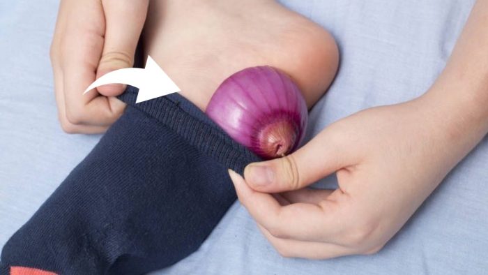 Poner 1 rodaja de cebolla en los calcetines antes de dormir: el remedio de los abuelos